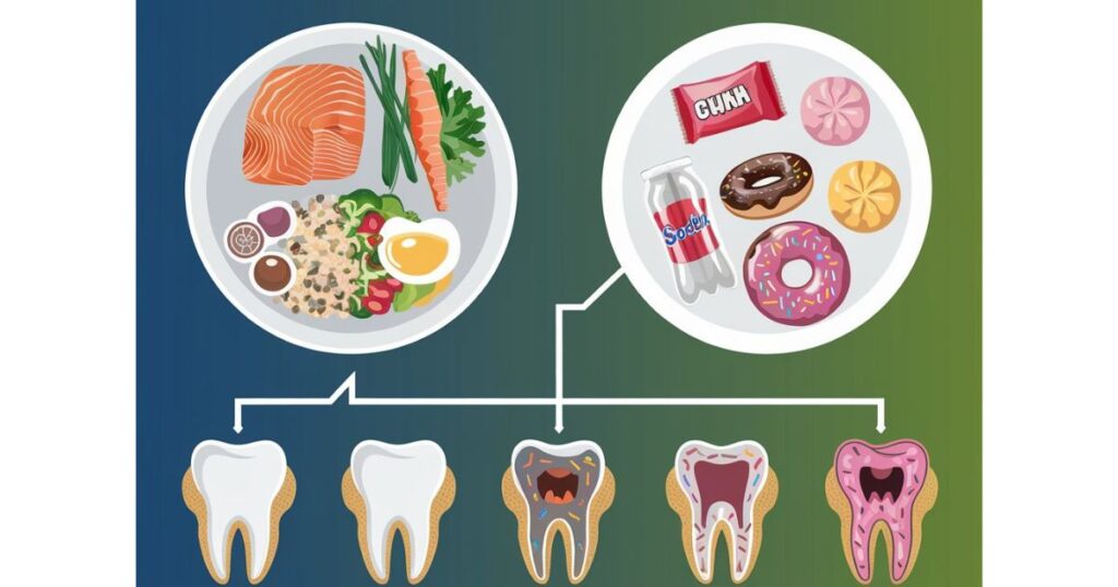 The Role of Diet in Dental Health